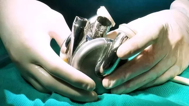 Srdeční implantát TAH od BiVACOR