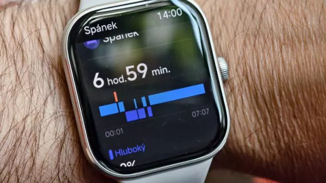 Xiaomi Redmi Watch 5