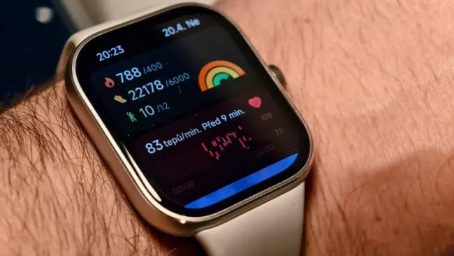 Xiaomi Redmi Watch 5