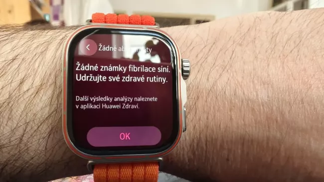 Huawei Watch Fit 5 Pro 