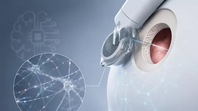 Neuralink hlásí pokrok: propíchl mozkové "brnění" a nemusel ho přitom rozříznout